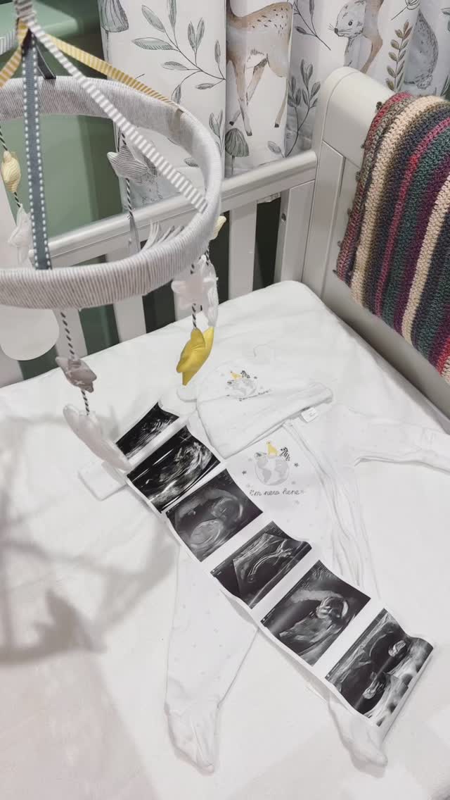 ✨Exciting news!✨ I’m so happy to share that I’m expecting a baby at the end of January 💕
As I prepare for this new chapter, my availability will be more limited over the next few months. I’ll still be taking on a small number of appointments, so please book early if you’d like a slot before baby arrives.
Thank you all so much for your continued support — it means the world! 🤍
.
.
.
.
.
.
#hairpieces #newassistant #newbaby #babyannouncement #january2026 #lacewigs #wigmaking #hairextension #frontlacewig #toppers #wigsforalopecia #wigstyling #wigrepairservice #wigmaker #wigknotting #wigfoundation #wigmakersunite #OncologyAesthetics #bournemouthwigs #alopeciauk #bournemouthhair #hairlossuk #hairlosssolutions #naprawyperuk #humanhairtopper #europeanhairtopper