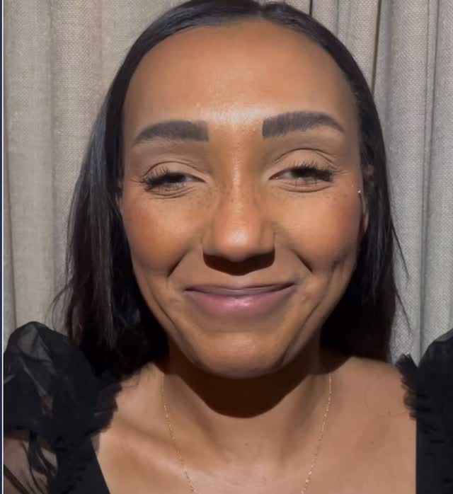 The images reflect before-and-after outcomes of neurotoxin Botox wrinkle-relaxer treatments by Dr.Prince, DNP, FNP-BC.
✨ You can see smoother skin, softened motion lines, and an overall refreshed look.
#HandcraftedAesthetics #BotoxResults #NaturalBeauty #ColumbusMedSpa #GlowWithConfidence
#medspa