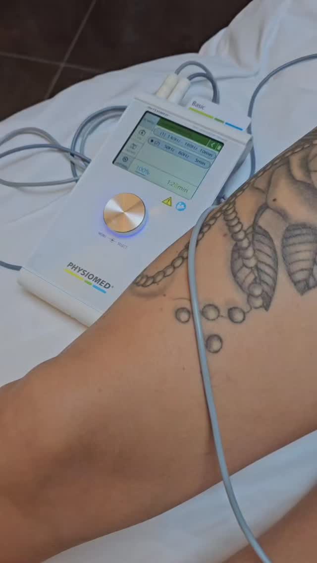 This client is 5 weeks post liposuction and abdominoplasty and she has been seeing me from advice of her surgeon.
A Deep Oscillation Therapy (DOT) machine is a medical rehabilitation device designed to promote healing and recovery after surgery or injury through the use of gentle, pulsed electrostatic fields. This technology creates deep, biologically effective oscillations within the tissues of the body, making it a non-invasive and highly effective therapy for reducing pain, swelling, and inflammation.
#lymphaticdrainage #postsurgerylymphaticdrainage #hemelhempsteadmums #scarrelease