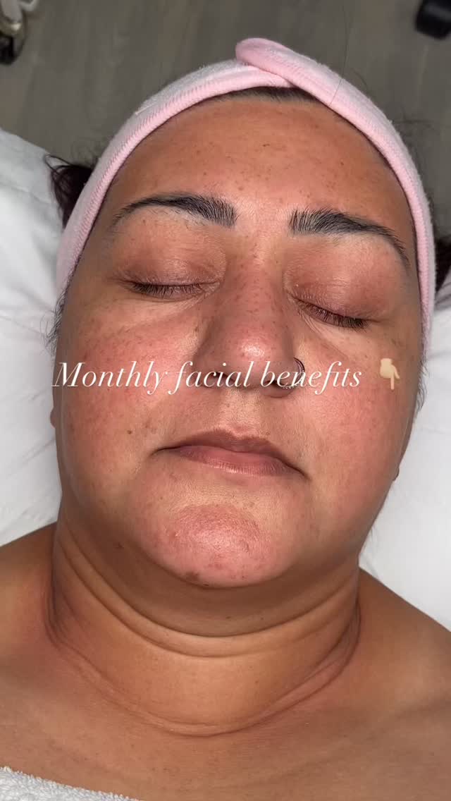 Are you looking for a way to improve your skin’s health, relaxation, and overall appearance?
A monthly classic facial might be the perfect solution. Here’s a breakdown of the benefits:
Enhanced Skin Health
Regular facials can significantly improve the health of your skin.
Here’s how:
Deep Cleansing: Facials remove dirt, oil, and impurities that accumulate over time, preventing clogged pores and breakouts.
Exfoliation: Gentle exfoliation removes dead skin cells, promoting cell turnover and revealing brighter, smoother skin.
Improved Circulation: Facial massage stimulates blood flow, delivering essential nutrients and oxygen to skin cells.
Detoxification: Facials can help eliminate toxins and impurities, contributing to a clearer complexion.
Deep Relaxation
Beyond the physical benefits, facials offer a wonderful opportunity for relaxation and stress relief. Enjoy these benefits:
Stress Reduction: The gentle mas reduce stress and promote relaxation.
Improved Mood: The release of endorphins during a facial can boost your mood and leave you feeling refreshed.
Self-Care: Taking time for a facial is an act of self-care that can improve your overall well-being.
A monthly facial can dramatically improve your skin’s appearance. Look forward to these visible results:
Brighter Complexion: Exfoliation and cleansing reveal brighter, more radiant skin.
Reduced Fine Lines: Increased circulation and hydration can help to reduce the appearance of fine lines and wrinkles.
Improved Skin Tone: Regular facials can help to even out skin tone and reduce hyperpigmentation.
Enhanced Product Absorption: Clean, exfoliated skin absorbs skincare products more effectively, maximizing their benefits.
Next Steps
Ready to experience the benefits of a monthly classic facial?
Book your consultation with Naz
#monthlyfacial#milliondollarfacial#glowglowing#glowingskin#beauty#aesthetcs
