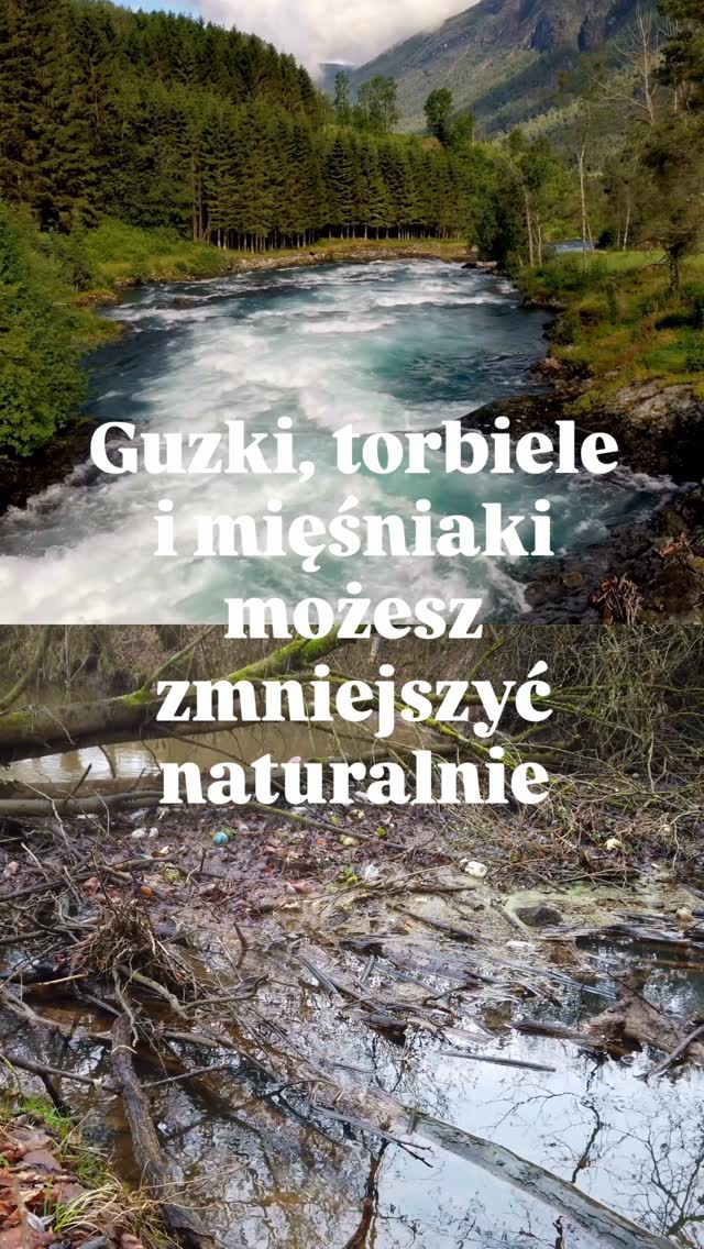 🍀Którą rzeką chcesz być? Wybierasz 🌊 przepływ czy zastój?
Z perspektywy medycyny chińskiej takie zmiany jak guzki, torbiele czy mięśniaki to nagromadzenia i zastoje – miejsca, w których energia i krew przestają swobodnie krążyć i gromadzi się śluz.
Tak jak w rzece, gdzie woda płynie lub stoi w zastoju, w ciele energia i krew też muszą swobodnie krążyć. 🌿 Akupunktura i zioła pobudzają naturalny przepływ, rozluźniają to, co zastygło, oczyszczają koryto rzeki ze śmieci, gałęzi, i wspierają ciało w naturalnych procesach regeneracji.
🔍 Pamiętaj! Każda terapia powinna iść ręka w rękę z opieką lekarza – medycyna chińska może być jej pięknym uzupełnieniem.
📩 Zostaw w komentarzu hasło „guzki”, a wyślę Ci link do artykułu, w którym tłumaczę, jak akupunktura i zioła wspierają ciało, gdy zaczyna gromadzić i tworzyć.
Zaopiekuj się sobą w Bertha Holistic 🌿
•••••••••••••••••••••••••••••••••••••••••••••••••••
🌱 Wsparcie płodności, zdrowia, emocji, urody.
🌸 Beata Szlachta - ekspert medycyny chińskiej
❤️ Bertha Holistic Centrum medycyny naturalnej we Wrocławiu.
☘️ Akupunktura, zioła, medycyna chińska, terapie twarzy.
•••••••••••••••••••••••••••••••••••••••••••••••••••
Akupunktura zdrowotna, guzki piersi, guzki tarczycy, torbiele, mięśniaki, gruczolakowłókniak