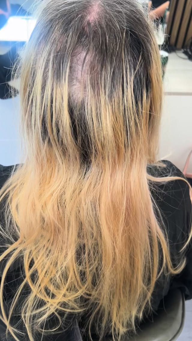 One Day…
Or day one?
Don’t keep putting off an appointment that can change your life!
DM us and get started on your dream hair
Full hair system and custom colouring