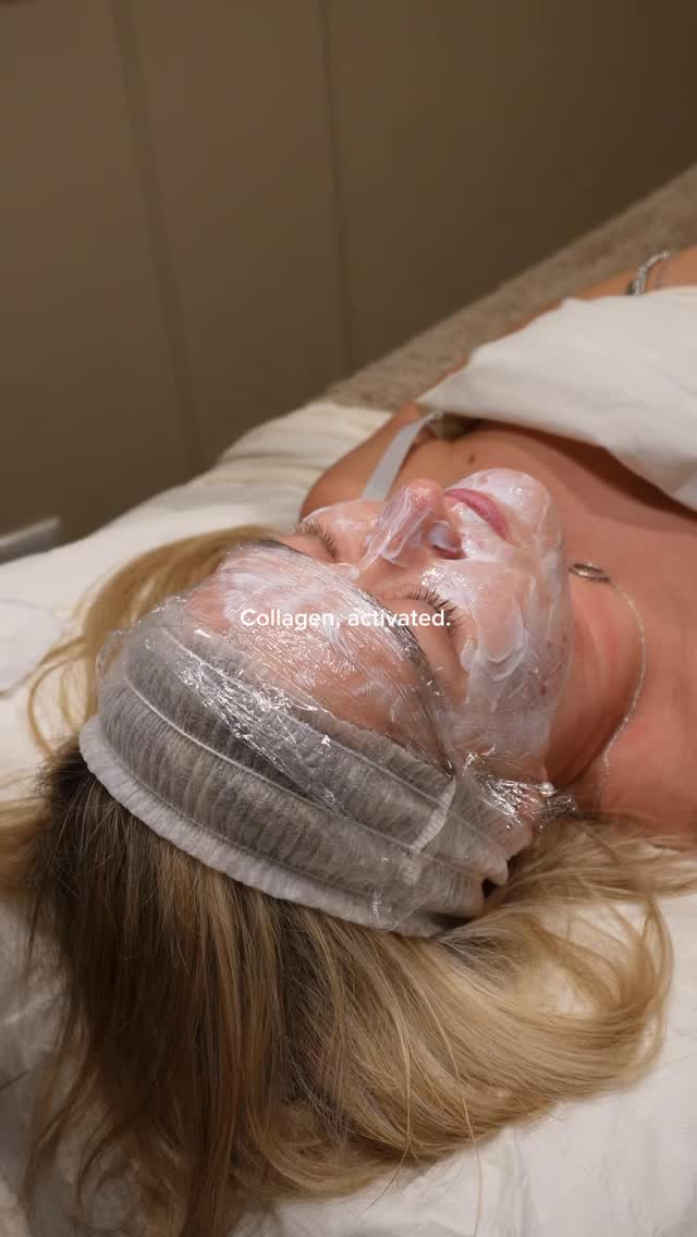 Collagen, activated 💉✨
Microneedling x Radio Frequency uses tiny needles and gentle heat energy to work beneath the skin, reactivating collagen and elastin for firmer, smoother, glowing skin 🤍
The result?
✨ Improved texture
✨ Tighter, lifted skin
✨ Long-term glow
#woking #medispa #beauty #glassskin #microneedling #radiofrequencyfacial #collagen