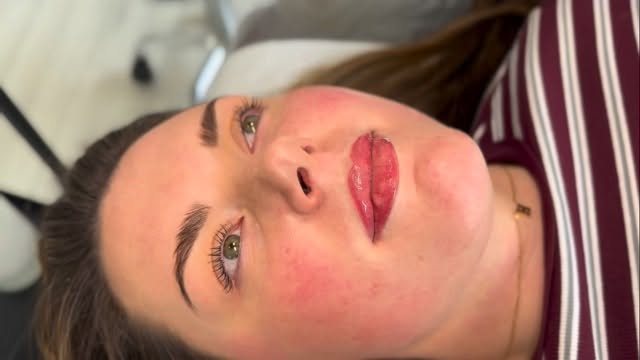 Then most beautiful lip blush ever!
This will heal 30-40% lighter but wow look at that colour! Absolutely obsessed! Using @permablend_pigments always!
#huntly #aberdeenshire #aberdeen #skinclinic #banff #insch #elgin #spmu #spmulips #pmulips💋 #lipblush #lipblushtattoo #finelinetattoo #aestheticsclinic #aestheticsclinicuk