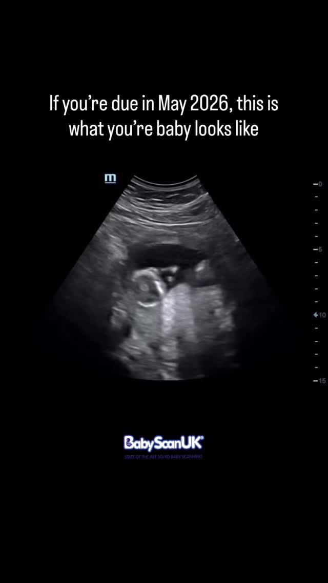 If you’re due in May 2026, this is what your tiny miracle looks like right now🤍✨
Only 14 weeks and already stretching, kicking, wiggling and showing off inside the womb!
These early movements are such a magical moment to witness - and we love capturing them for you🫶🏼
Whether you want reassurance, to bond, or just to see your little one moving around, our Early & Reassurance scans are here for you 💫
📍 Nelson
📆 Early scans from 8 weeks
🌐 Book online: babyscanuk.co.uk
#BabyScanUK #14WeeksPregnant #EarlyScan #ReassuranceScan #PregnancyJourney #May2026Baby #MumToBe #BabyInTheWomb #ScanVideo #BabyBonding