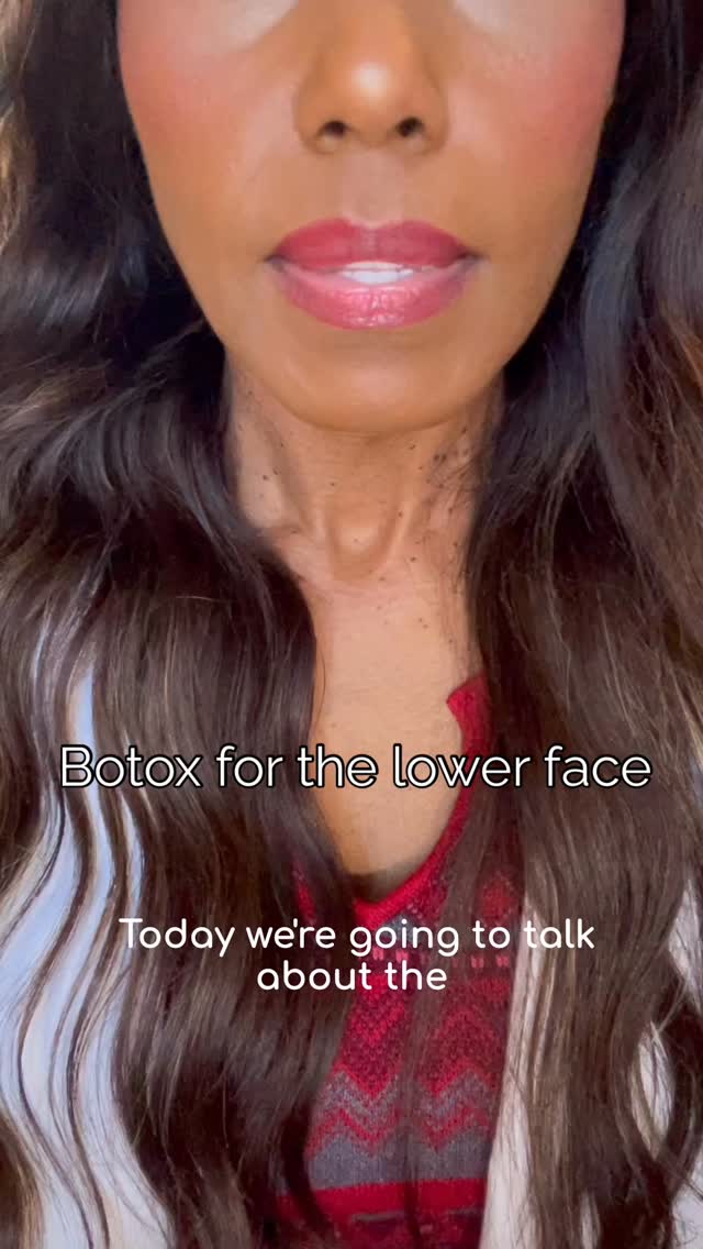 Softening the DAO with Botox = a lifted, happier appearance + a slimmer lower face. Small treatment, big impact ✨
#DAOBotox #LowerFaceSlimming #BotoxResults #AestheticMedicine #FacialBalancing #NaturalAesthetics #HandcraftedAesthetics #BotoxExpert