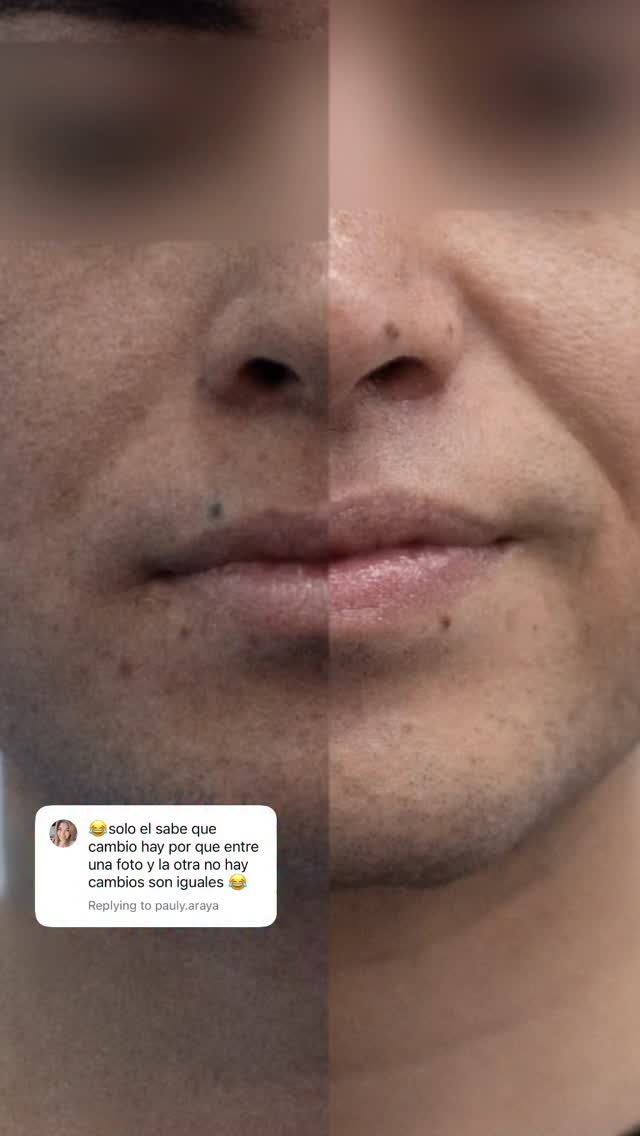 No te preocupes, yo te explico 🫶🏼