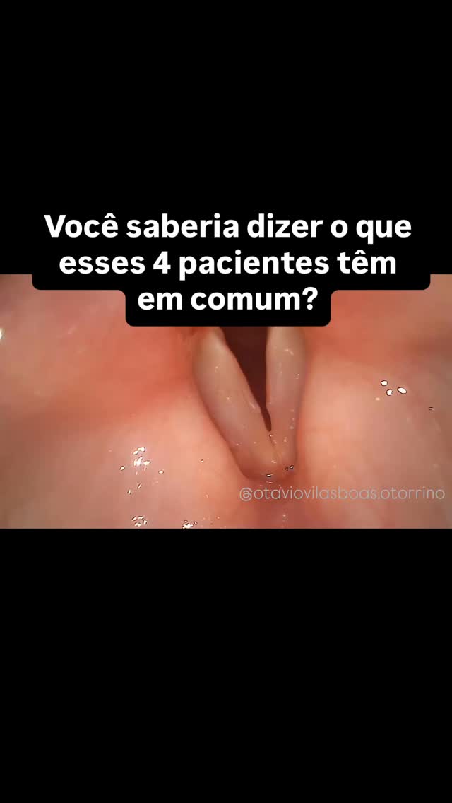 Respostas aqui embaixo nos comentários!
#voz #laringologia #laryngology #fonoaudiologia #otorrinolaringologia #voicesurgery #voice #voicesurgeon #