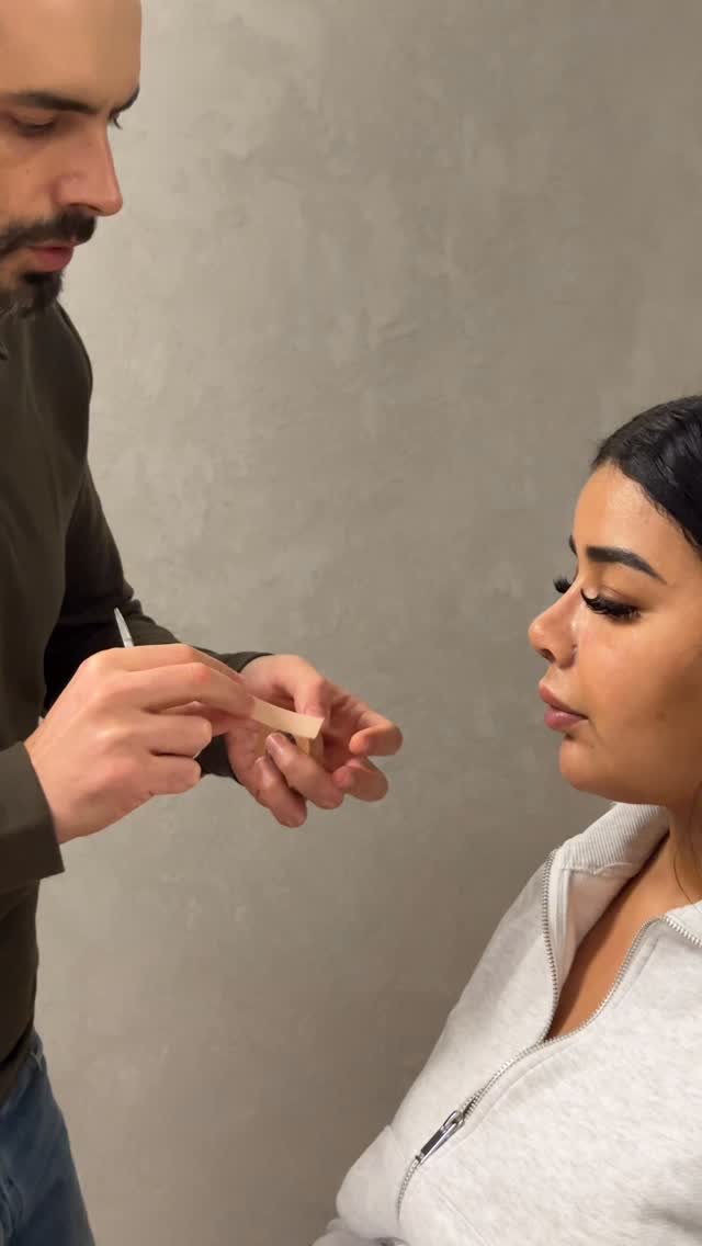 after cast removal on 6th day.