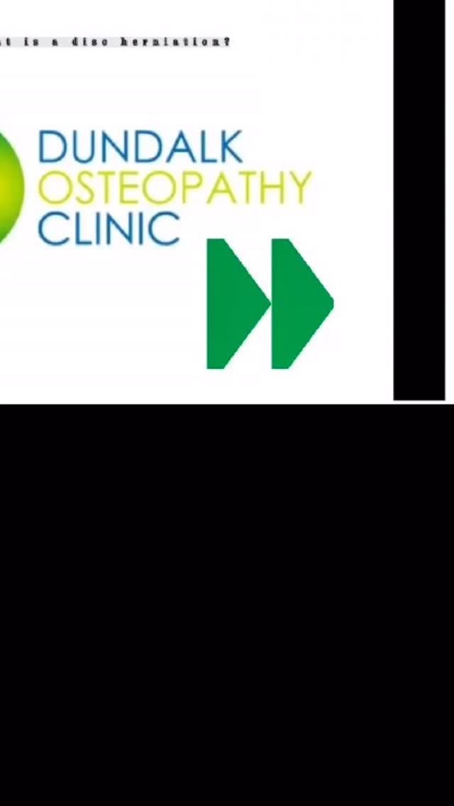 Are you suffering from Lower back pain with leg symptoms?
It could be a lumbar disc herniation — a disc pushing onto a nerve.
❤️ Good news: most calm down with proper treatment + movement.
You’re not broken.
🔹 Dundalk Osteopathy Clinic — Expert back care.
📩 DM “BACK” for more info from Dundalk Osteopathy Clinic. #dundalkosteopathyclinic #dundalkosteo #dundalkosteopath #dundalksportsmedicine #backpain #hippaindundalk #procycling #sciaticapain #sciatica #sciaticarelief #sciaticatreatment #onlinelowbackpainprogram #icebath #icebath❄️ #c11recovery