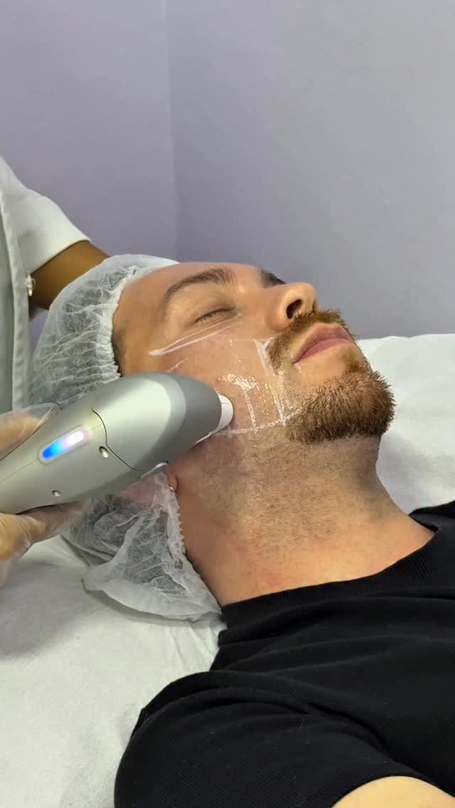 Parte 3 | Voltei na @procorpoestetica e fiz o Ultrassom Micro e Macrofocado 🤍 Eu amo!
Spoiler: parte 4 vem aí! 👀 Em breve eu volto e mostro pra vocês o resultado.
#ultrassom #ultrassommicrofocado #ultraformer #contornofacial #harmonizacao #publi