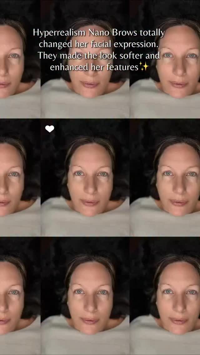 Hyperrealism Nano Brows totally changed her facial expression.
It’s a small detail, but the difference is amazing ✨
The brows look softer, her gaze became gentler, and her features stand out in such a beautiful way.
It’s one of those results where you look and think: “This is exactly how it should look.”
I really love this soft but noticeable transformation.
Do you like it?
____________________________________________________
Permanent Makeup Services, Tattoo Removal & Carbon Laser Facial
⬆️Book apt with the link in bio
✨Free Consultation available
📍Oshawa, Ontario
✉️ browsbyieva@gmail.com
📱 +1 416-804-6749
Website: permanentbeautybyieva.com
#nanobrows#oshawa#oshawabrows#oshawaontario#oshawatattoo#oshawasalon#oshawapermanentmakeup#browtransformation#hyperrealismbrowstoronto#torontomicroblading#scarboroughmicroblading #permanentbeautybyieva #whitbymicroblading#microbladingwhitby#microbladingoshawa #nanobrows #nanobrowscanada#nanobrowstoronto #torontonanobrows#nanobrowsmarkham#hyperrealismbrows#whitbytattoo#browstoronto#trend#trending#beautytrends#torontobeauty#oshawasalon#oshawaontario#brows#browartist