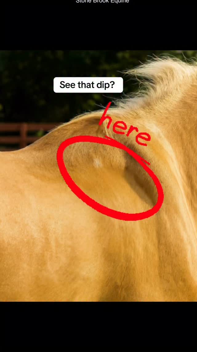 Is your horse hollow in front of the wither… but bulging right behind the scapula?
This uneven shape isn’t just “how they’re built.” It’s a classic sign of scapular restriction + compensatory muscle tension.
Here’s what this usually means:
🌿 The hollow area — the muscle isn’t engaging. It’s often inhibited because the shoulder blade can’t glide freely.
🌿 The bulge behind it — that’s your horse’s body trying to stabilize what isn’t working correctly.
🌿 The result? Shortened stride, choppy transitions, difficulty lifting the back, and resistance in the neck and poll.
How to Help Your Horse
✨ Massage
Release the overworked triceps and subclavian region to restore balance and reduce the bulge.
✨ Acupressure Points
SI9 & SI11 to unlock shoulder mobility
LI15 to reduce tension and encourage muscle function
BL13–BL15 line to support postural lift
✨ Rehab Exercises
Carrot stretches toward the girth and down low to lengthen the shoulder muscles
Pole work to encourage proper protraction
Walk-in-hand lateral work to wake up the hollowed muscle and restore symmetry
If your horse has this shape, you’re not alone — it’s one of the most common patterns I see.
Follow me for more equine bodywork tips and learn how to fix these issues step-by-step inside
✨ Stone Brook Academy ✨
🌿 Comment LEARN for your free acupressure guide
#holistichealth #holistichealing #healer #massage #equestrian
