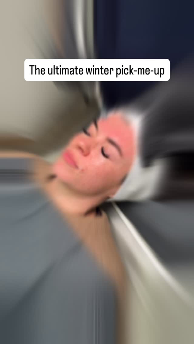 This dreamy combo will leave your skin looking tight, bright & glowing 🤩
Skin feeling dull? Wrinkles taking over your face? Microneedling followed immediately by a skin booster plus Dolltox 🤌🏼
Next available space is 18th December in Barnham. DM for cancellations list 📋