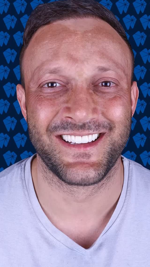 ✨In such a short time, we’ve grown into a remarkable family.
With the latest technology, we continue to help our patients achieve healthier, brighter smiles.
#siriusdental #smileturkey #hollywoodsmiles #dentalimplant #dentalclinic