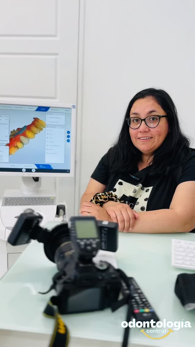 ¡No lo podía creer!
Me hicieron la corona de cerámica en el mismo día! gracias a la tecnología CEREC.
Todo comenzó con un escaneo digital, sin masas ni impresiones incómodas. En segundos ya tenían el modelo 3D de mi diente.
Después, ¡pude ver cómo diseñaban mi corona en el computador!
Y lo mejor: la máquina la fresó ahí mismo!
En el mismo día ya tenía mi corona… quedó perfecta, se ve y se siente como un diente natural. En mi caso fue porque tenía una antigua de metal con cerámica y estaba totalmente desajustada, por eso visité la clínica, y no me arrepiento para nada! 😀
Me encantó que:
✨ No tuve que usar coronas provisorias
✨ No tuve que volver otro día
✨ Todo fue más cómodo y preciso
✨ El color quedó exactamente igual a mis dientes
✨ ¡Y todo totalmente digital!
De verdad, es impresionante cómo la tecnología hace que un tratamiento que antes tomaba semanas, hoy esté listo en una sola visita.
“CEREC es otra experiencia.”
#OdontologíaDigital #Implantología #cerec #DiseñoDeSonrisa #CarillasDeCerámica #drvictorvarela #SmileDesign #Curanilahue #Concepción #OdontologíaEstética #Lebu #Arauco #dentistacuranilahue #coronadeceramica #chairsidedentistry #instacuranilahue #odontologiacentral #cerec #digitaldentistry #dentistadigital