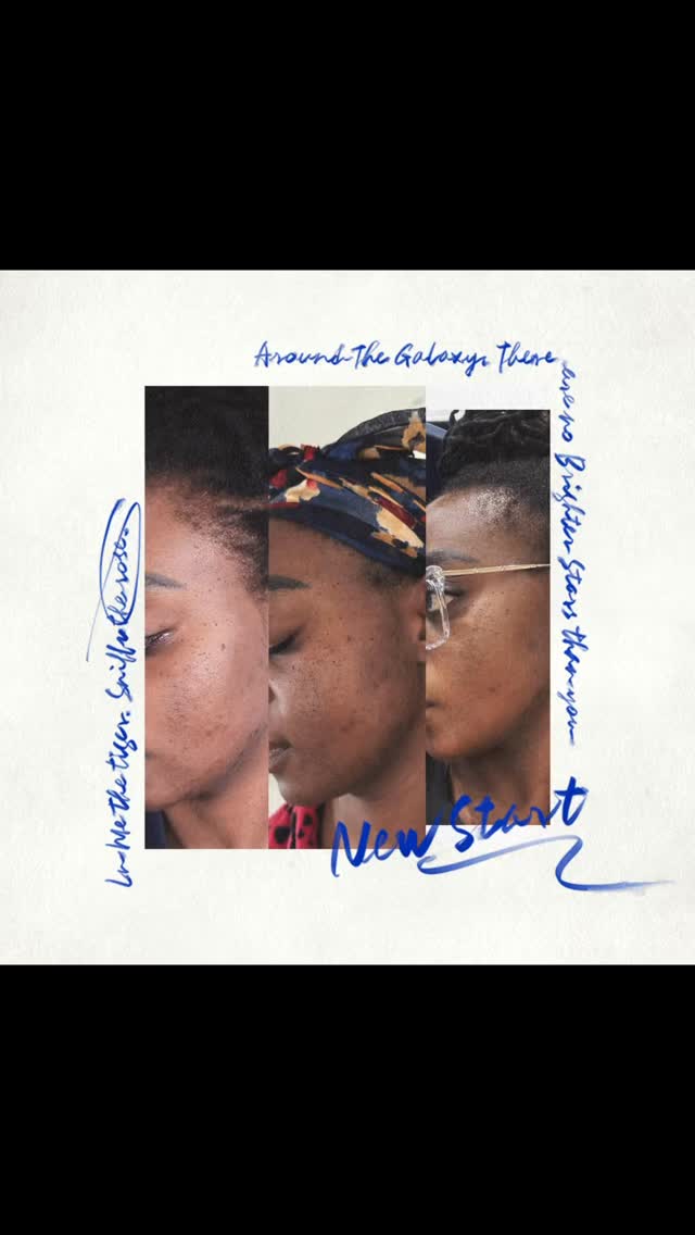 Get Yours Today! OPHIR 23K brightening serum+ Rhema Chemical Peel! New horizon mall unit C35a #skincare #lighteningfacialserum #yycskin