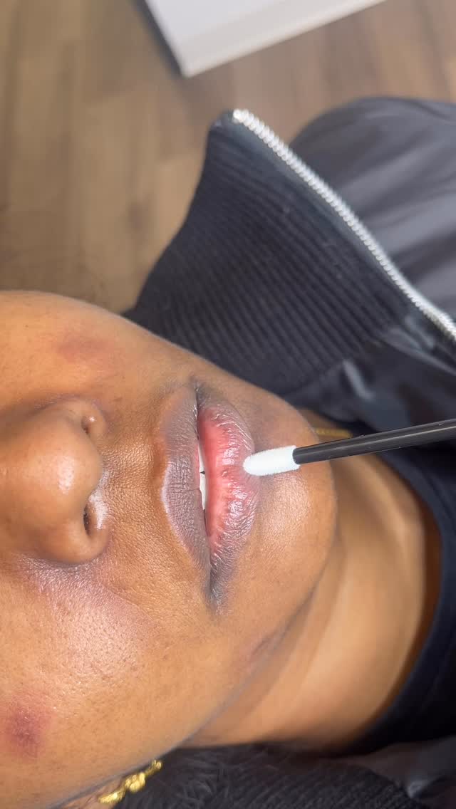 Our beautiful client opted for Lip Camouflage instead of Lip Neutralization.
We were able to successfully camouflage the hypopigmented areas of her lips to match the surrounding lip hue. A customized ink formula was created to conceal the discoloration. 2-4 sessions will be needed for optimal results.
If you have uneven lip pigmentation due to genetics, smoking, vitiligo, dryness or an immune disorder, consider #LipCamouflage to undetectably conceal it.
BEAT & BLADE
📍Houston
(832) 377-5677
www.beatandblade.com
info@beatandblade.com
“Enhancing Lives One Image At A Time”™️
#lips #liptattoo #darklips #houstontattooartist #medicaltattoo #vitiligo #viral #fyp