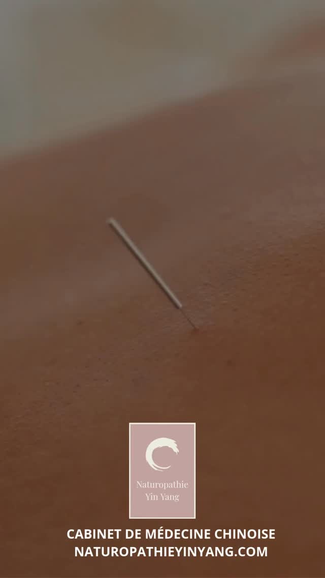 #acupuncturecasablanca #acupressioncasablanca #médecinechinoisecasablanca #bienêtrenaturel #acupuncture #douleurschroniques