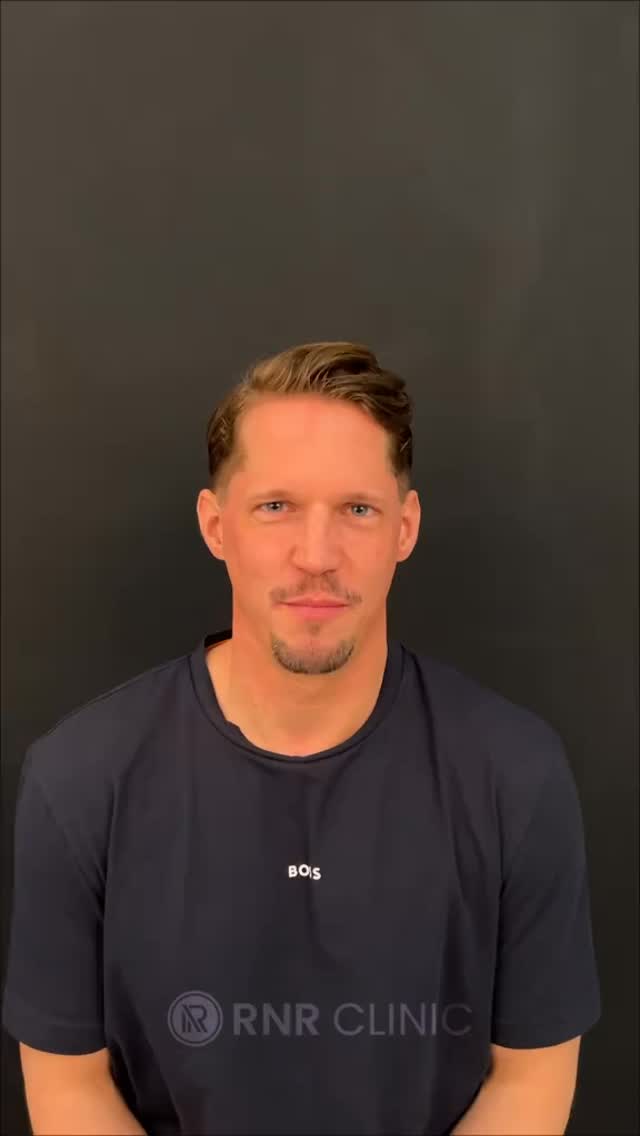 Lassen Sie sich von Ihrem Traumlächeln inspirieren!
Jetzt kostenlose Beratung sichern – inklusive individuellem Angebot! 💫
📍 In Istanbul bei RNR Clinic Turkey – Experten für ästhetische Zahnbehandlungen.
#rnrclinicturkey #dentalaesthetics #smilemakeover #zahnästhetik #hollywoodsmile #istanbulclinic #zahnbehandlung #perfectsmile #dentalcare #smiletransformations #fyp #dental #international #deutschland