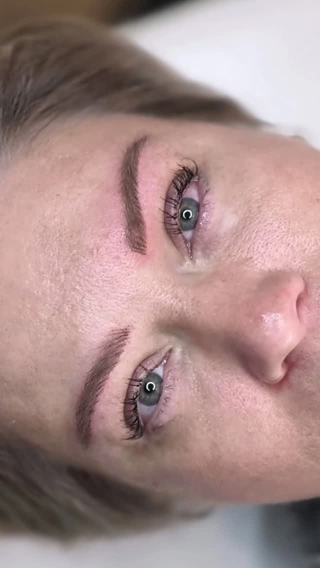 SOURCILS POIL A POIL HYPERREALISTES - Création
Avant | Après
Pour rappel: sur la vidéo la pigmentation vient d'être faite, les sourcils sont donc rouges, un peu gonflés et la couleur du pigment ressort foncé. Après les 3 semaines de cicatrisation, les sourcils auront perdus 40 à 50% d'intensité (cicatrisation normale), pour laisser place à une couleur beaucoup plus douce et un résultat plus fin. Lors de la retouche 1 mois après nous rectifions la forme et l'intensité si nécessaire. LES SOURCILS NE RESTENT PAS FONCÉS COMME CA, n'ayez craintes 😊 C'est pour cela que je vous montre souvent les résultats cicatrisés. 🫶
📍 Homblières (02720) — salon privé, sur RDV uniquement
🗓️ Ouvert du lundi au samedi matin (non-stop le midi)
❓️💸https://taplink.cc/regardpoudre
📲 📞 06 49 57 28 05
#nanobrows #sourcilshyperrealistes #poilàpoil3d #sourcilspoilàpoil #pigmentationsourcils #maquillagepermanent #maquillagesemipermanent #dermopigmentation #esthetique #homblieres #aisne #hautsdefrance