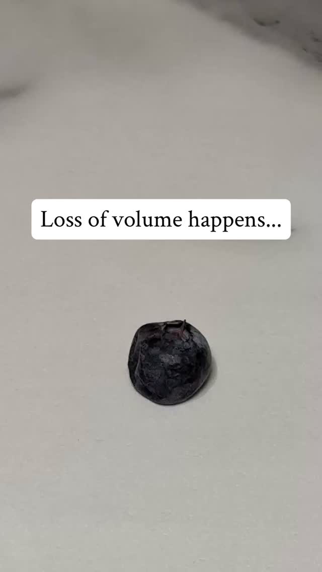 Watch how with just a littler filler, this lifeless blueberry regains its volume!
.
One syringe of filler is 1 mL which is equivalent to about 1/5 of a teaspoon or one blueberry. When a provider, suggests multiple syringes of filler, it's not as scary as you might think because in reality each syringe is not a lot of volume.
.
Just like in the blueberry, filler is great for restoring volume, creating structural support and contour, softening folds and lines and improving symmetry.
.
Not sure which is best for you? Schedule your complimentary consultation today! šš»
š»www.allure-dbq.com
š 563-258-4698
š§ info@allure-dbq.com
.
Nicole Powers, ARNP, AGNP-BC
@nicolepowers_np
#dubuque #dubuqueiowa #iowa #nursepractitioner #medspa