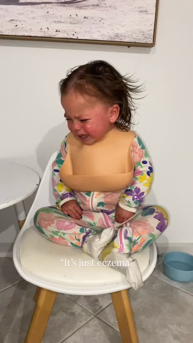 When people say ‘it’s just eczema’
It’s relentless itching, distress, poor sleep and a constantly overwhelmed nervous system.
It’s the years I wish I could get back with my baby.
Eczema is rarely just a skin issue.
More often, it reflects a deeper imbalance within the body,
allergies, food sensitivities, digestive struggles, behavioural challenges,
sleep disruption, asthma and immune stress.
If this is your reality right now, you are not alone 🤍
#EczemaAwareness #ItsNotJustEczema #ChildhoodEczema #BabyEczema
#ChronicSkinConditions #HolisticHealth #RootCauseHealing
#NervousSystemRegulation #ImmuneHealth #GutSkinAxis
#AllergyAwareness #SleepDeprivedParents #MaternalMentalHealth
#ParentingThroughIllness #InvisibleIllness #SensitiveChildren
#HealingJourney #YouAreNotAlone