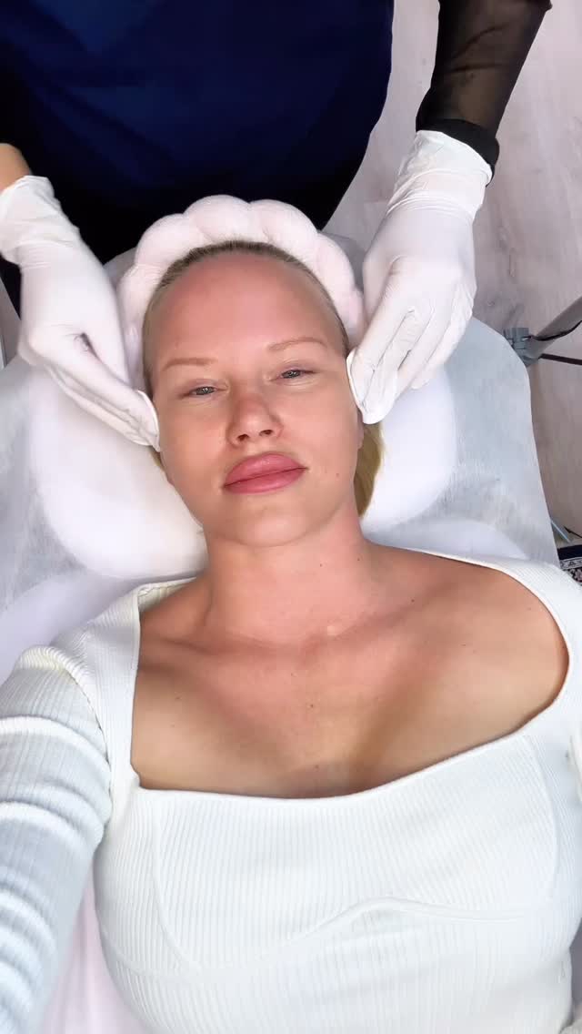 Ihana yhdistelmähoito, jossa kuorinnan avulla saa kirkastusta ihoon ja Profhilosta syväkosteutusta. ✨✨