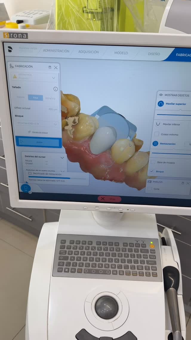 #curanilahue #dentistacuranilahue #odontologiacentral #cerec #drvictorvarela #odontologiadigital #diseñodesonrisa #clinicadentalcuranilahue