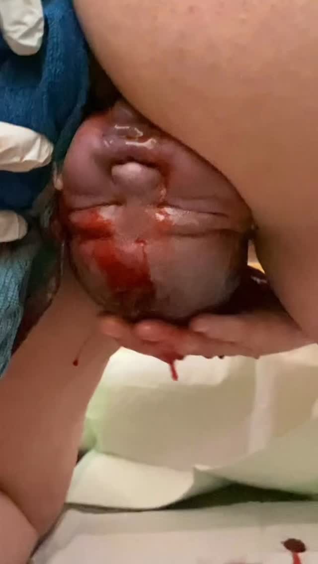 🎥: @the_birth_home
The first hands to welcome a baby earthside don’t need to be a provider’s.
They can be the mother’s own.
Touching her baby’s emerging head activates connection, confidence, and instinct.
Birth is not something done to her.
it’s something she is doing.”
🌿🤲 #TrustBirth #Birth #NaturalBirth #PhysiologicalBirth #EmpoweredBirth #BirthPhotography #DoulaLife #BirthDoula #HolisticBirth #CalmBirth #WaterBirth #PositiveBirth #BirthWithoutFear #PregnancyJourney #BabyOnTheWay #EvidenceBasedBirth #MindfulMotherhood #FourthTrimester #BirthingFromWithin #TrustBirth #DoulaHeatherTaylor
