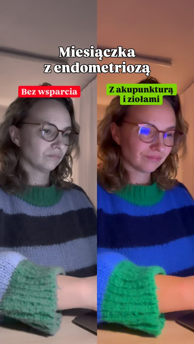 Endometrioza może odbierać radość życia – silny ból, skrzepy, wzdęcia, trudna owulacja i chroniczne zmęczenie.
Ale wsparcie akupunkturą i ziołami zmienia cykl miesiączkowy: ból łagodnieje, skrzepy znikają, owulacja przestaje być koszmarem, brzuch staje się lekki, emocje stabilizują się, a energia wraca.
Twoje ciało może przestać być wrogiem – możesz zacząć czuć, że współpracuje z Tobą.
Zaopiekuj się sobą w Bertha Holistic. 🌿
A Ty jakie masz objawy endometriozy? A może masz powyższe objawy bez diagnozy endometriozy? 💬 Napisz w komentarzu.
•••••••••••••••••••••••••••••••••••••••••••••••••••
🌱 Wsparcie płodności, zdrowia, emocji, urody.
🌸 Beata Szlachta – ekspert medycyny chińskiej
❤️ Bertha Holistic Centrum medycyny naturalnej we Wrocławiu.
☘️ Akupunktura, zioła, medycyna chińska, terapie twarzy.
•••••••••••••••••••••••••••••••••••••••••••••••••••
#endometrioza #akupunktura #wrocław #płodność #medycynachińska #TCM #zdrowiekobiety #bólmiesiączkowy #holistycznie