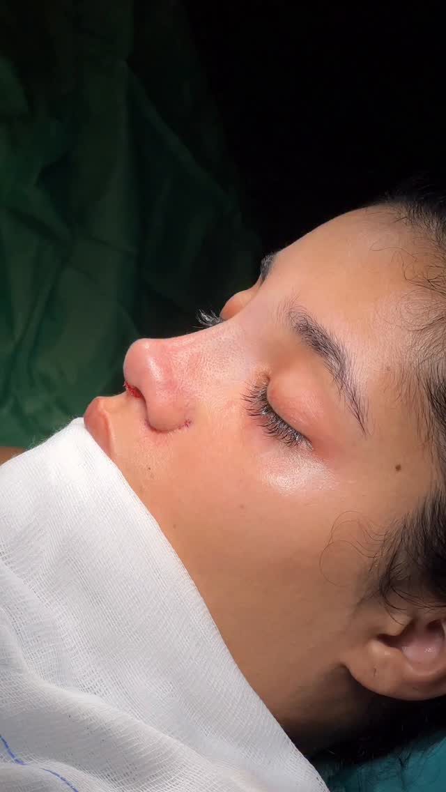 when the surgery is over⭐️