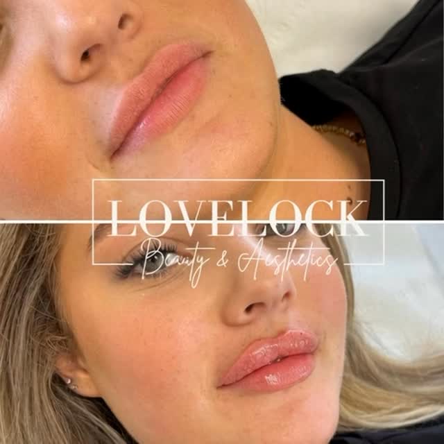 “New lips, who dis? Full, fierce, and flawlessly sculpted.” @lovelock_beauty_and_aesthetics
Level 7 Expert Practitioner. (Highest qualification in the aesthetics industry)
📍 Warminster 📍 Romsey
#trowbridge #warminster #westbury #devizes #frome #bathcity #southamptonbeauty #totton #romsey #eastleigh #bathspa #calne #bathcity #corsham #melksham #chippenham #southamptonuk #southamptonaesthetics