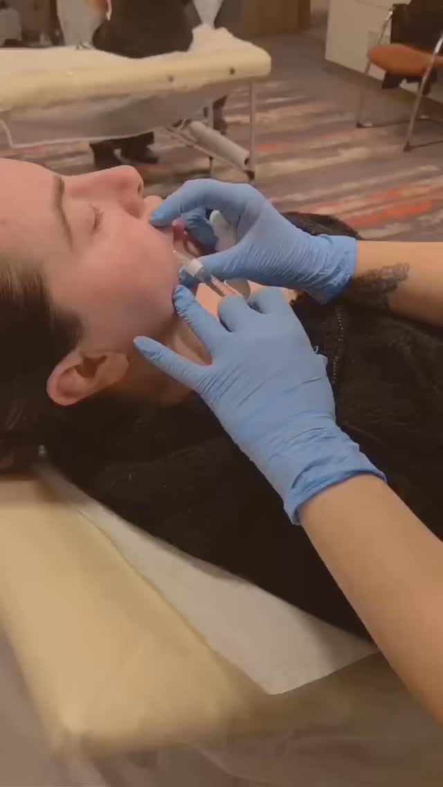 Nasolabial fold filler (the lines that run from the sides of your nose to the corners of your mouth) models wanted. 5th, 6th, 7th January - £45.
Please call us on 03339962690 or WhatsApp us on 07548346964 to book. 📲
Nasolabial fold filler can offer several cosmetic and confidence-boosting benefits.
⭐️ Softens deep smile lines
Filler adds volume under the fold, making lines look less deep and less shadowed.
⭐️Creates a more youthful appearance. Nasolabial folds deepen with age due to volume loss and skin laxity.
⭐️Immediate results. You’ll usually see improvement right away, with final results settling over 1–2 weeks.
⭐️Non-surgical. No surgery, minimal downtime—most people return to normal activities the same or next day.
⭐️ Can improve facial balance When combined with cheek or midface filler, it can lift the area naturally, often requiring less filler directly in the fold.#ampikasaesthetics #aesthetics #aestheticstrainingacademy #nasolabialfolds #filler