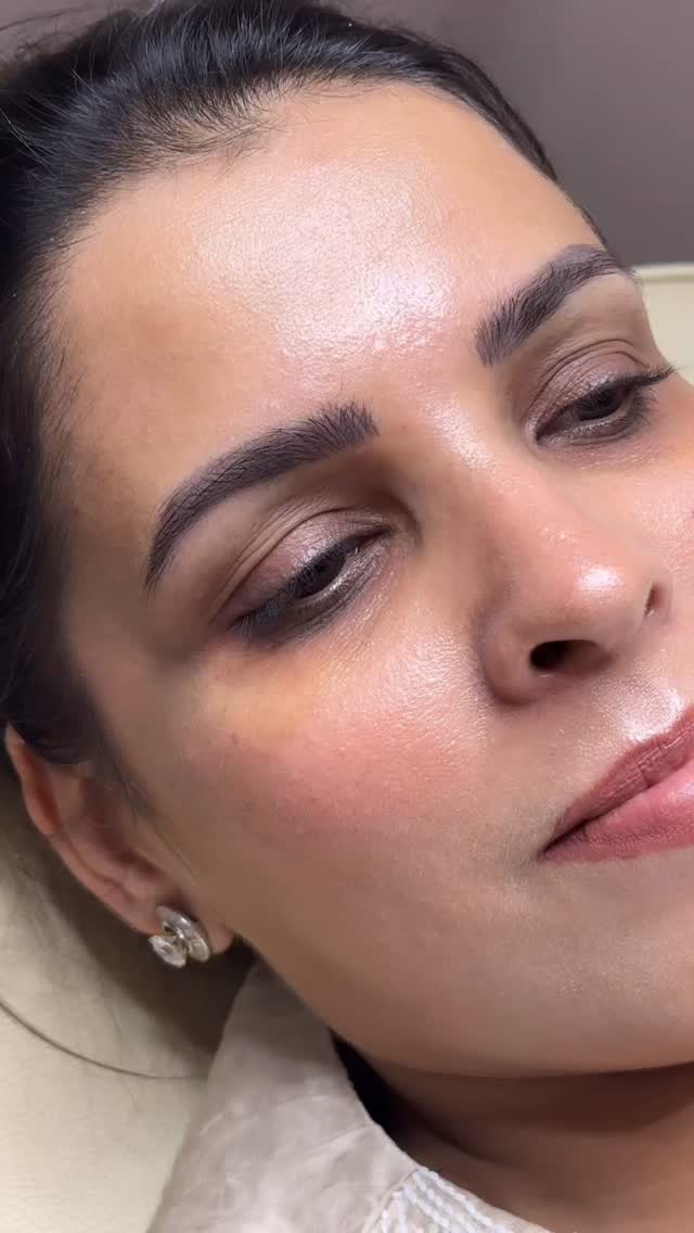 ✨ From flat to fabulous — in minutes! ✨
Say hello to the beauty upgrade your eyes have been waiting for. Our Lash Lift enhances your natural lashes with a lifted, curled, fuller look — all without extensions.
Wake up every day with wide-open, ready-to-go eyes that stay effortlessly gorgeous, smudge-proof, and low maintenance.
Whether your lashes are straight, downward, or simply need a boost, this treatment delivers a stunning curl that lasts 6–8 weeks.
A touch of elegance, a boost of confidence — your lashes, beautifully elevated.
✨ Performed by our Celebrity PMU Artist, Gagan Gandhi.
📩 Book your session now!