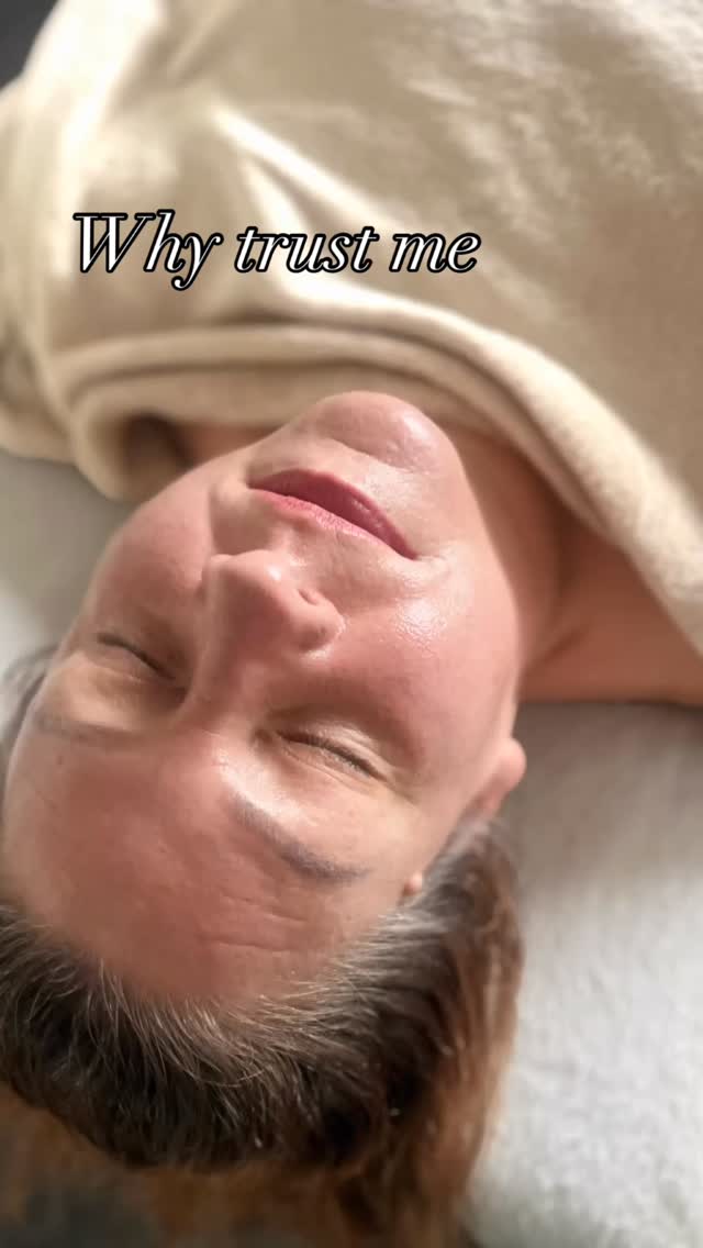 ❤️From acne, damaged skin barrier, clinical to relaxation I am able to offer over 80 different blends of facials to meet the needs of my clients skin !
This means i can support a diverse range of skins 🙌🏻
I don’t name all my facials individually as I like to have some freedom around what will be included in your treatment.
‼️Did you know I can layer medical grade chemical peels !! This means your skin is getting a very premium treatment .‼️
🥼🧬Due to Dermshield technology in the Noon Aesthetics products there is no to very minimal peeling post treatment.
I don’t have to get a fan to cool the skin , the patented formula stopped pain receptors so it’s not uncomfortable, the products used keep the skins PH levels in the correct place and keeps inflammation at bay…..
It’s not just skin, it’s understanding you as a person. It could be a couple of little adjustments needed to change your skin OR it could be bringing our nutrition specialist in to work with us looking at hormones, diet etc…
If you have tried other products which don’t help, please lean on me for help.
Anna ❤️
#leightonbuzzardmums #leightonbuzzard #leightonbuzzardskinclinic #leightonbuzzardfacials #leightonbuzzardaesthetics #miltonkeynesmums #glowingskin #holisticskincare #adultacne #hormonespots #whiteheads #clearacne #skininflammation #noonaesthetics #noonaestheticsuk #calmskin #skinspecalistbedfordshire #skingutaxis #breakouts #bedfordshire #menacne #ingrowinghairs #eczema #seborrheicdermatitis