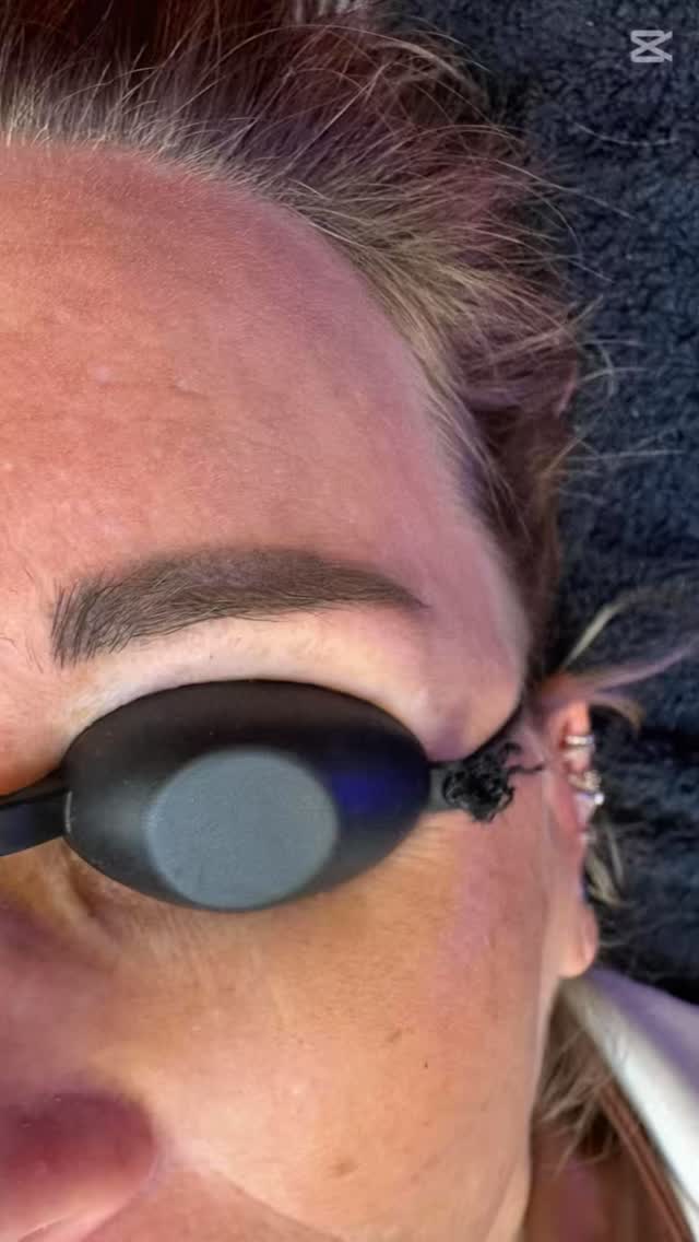 ✨ Anti-grijs laserbehandeling voor de wenkbrauwen
✔ Verwijdert grijze verkleuring door oude PMU
✔ Zuivere, frisse huid als basis
✔ Perfect voorbereid voor nieuwe Powderbrows
Www.sdibrows.nl 06-31763025
#inklessstretchmarksremoval #permanentmakeuplippen #permanentemakeup #pmu #pigment #wenkbrauwen #brows #browbar #sdibrows #miainkt #hairpigmentation #heerhugowaard #oudkarspel #Alkmaar #Noord-Holland #powderbrows #lipblush #lippigmentatie #academy #opleidingen # cursussen #microdermabrasie #microneedling #wax# #fullbodywax#