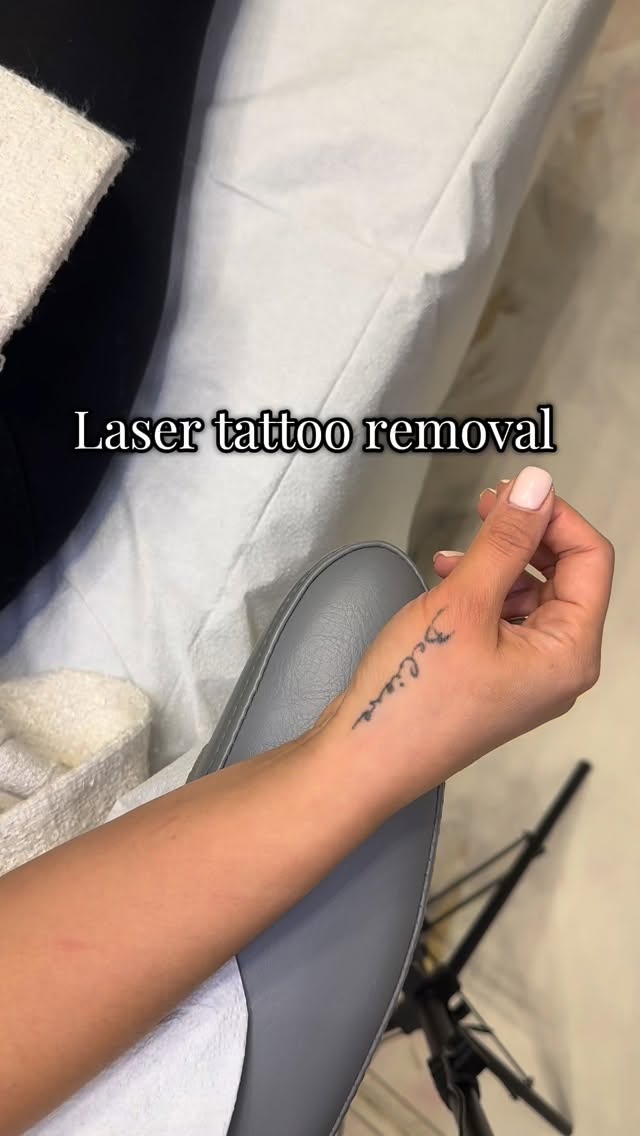 Laser tattoo removal ✨
Have a tattoo you no longer vibe with? Let’s remove it!
#laser #lasertattooremoval #tattooremoval #lasvegas #lv #medspa