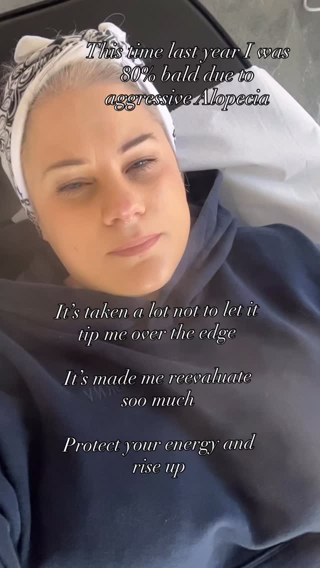 Owing, running and sustaining a business whilst working another job is hard graft!
I used to stress myself into burnout questioning myself multiple times a day, comparing, spending money , doing another course trying to make it all work.
As a results my body reacted and I have had to learn to chill 😎….. this has been made so much easier by all my amazing clients !
You keep coming back
You refer your friends
You compliment the experience
You ask for skin support
You feel safe to allow me to know you as a person
And more 🥰
Life gets tough, we are under constant demands ! It is ok to carve some time out just for you ☺️
Much love to all of those who have supported me through think and thin( excuse the pun) 😂
Right now I HATE MY HAIR! But i know it’s a process so we move……
Anna 😍
#leightonbuzzard #alopicia #alopiciaawareness #hairloss #selfcare #stress #leightonbuzzardmums #miltonkeynesmums #shorthair #mentalhealth #nervoussystem #relax