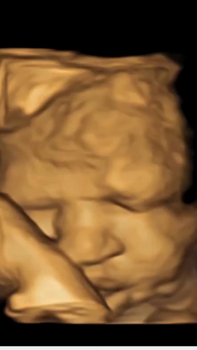 #verloskundige #zorg #baby #echo #echoscopie #zwanger