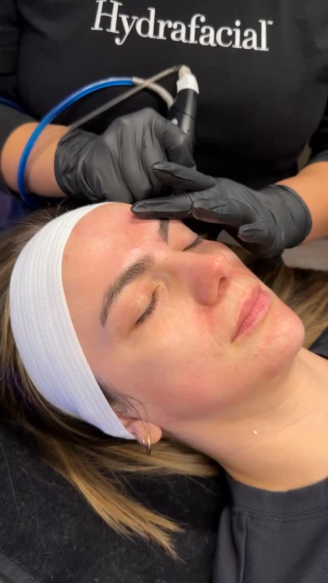 Après les fêtes, offrez à votre peau un glow immédiat ✨
Le Hydrafacial + booster Vitamine C est le soin idéal pour :
💧 hydrater en profondeur
✨ illuminer le teint
🌿 lisser le grain de peau
💄 sublimer le maquillage
Un soin express, une peau lumineuse et fraîche — parfaite pour votre peau après les fêtes.
📍 Institut C – Lyon 2
📞 06 86 16 85 71
#institutclyon #hydrafacial #vitaminc #glowdesfetes #soinvisage #eclatpeau #beautelyon #noel2025 #institutbeaute