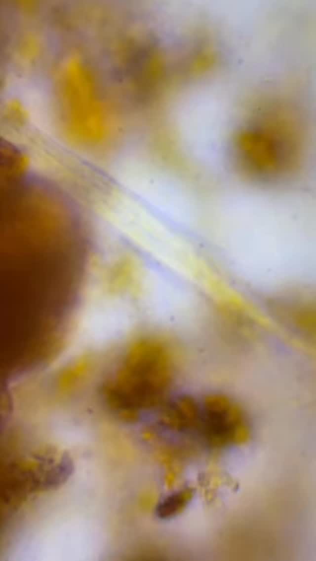 This is living soil under a microscope đ
Not pests. Not disease. Not something to âfix.â
That thin thread youâre seeing is fungal hyphae one of the most important parts of healthy soil. It helps move nutrients, improve structure, and support stronger plants without more inputs.
Healthy soil is alive.
Save and follow if youâre working on healthier soil!
#grozome, #plantcare #SoilBiology #LivingSoil #HealthySoil