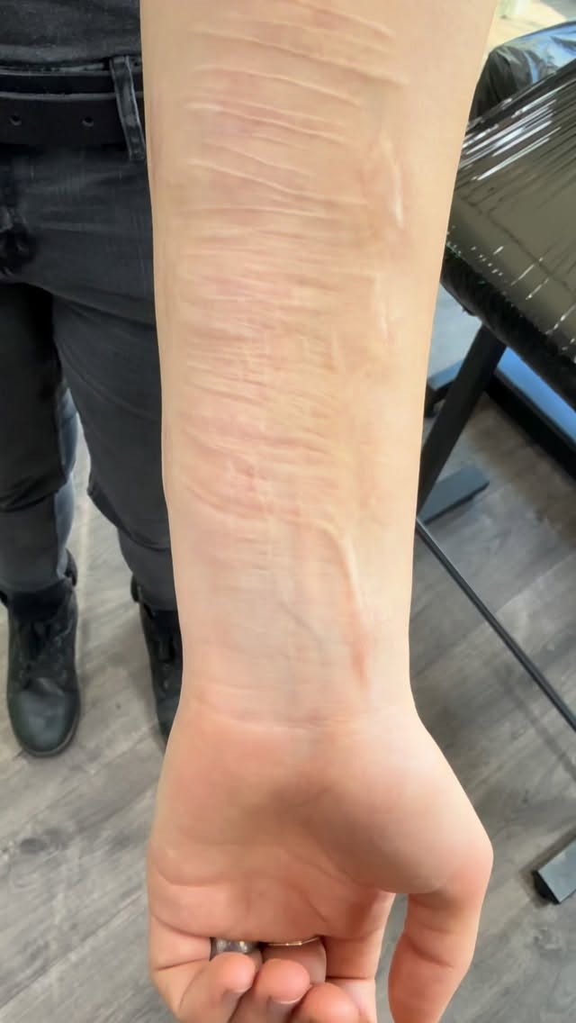 Narbenabdeckung mit einem individuell nach den Wünschen der Kundin gestalteten Design.
#tattoo #tattoos #tattooartist #ink #tattoolife #tattooart #inked #blackandgreytattoo #tattooideas #tattooist #coveruptattoo #scars