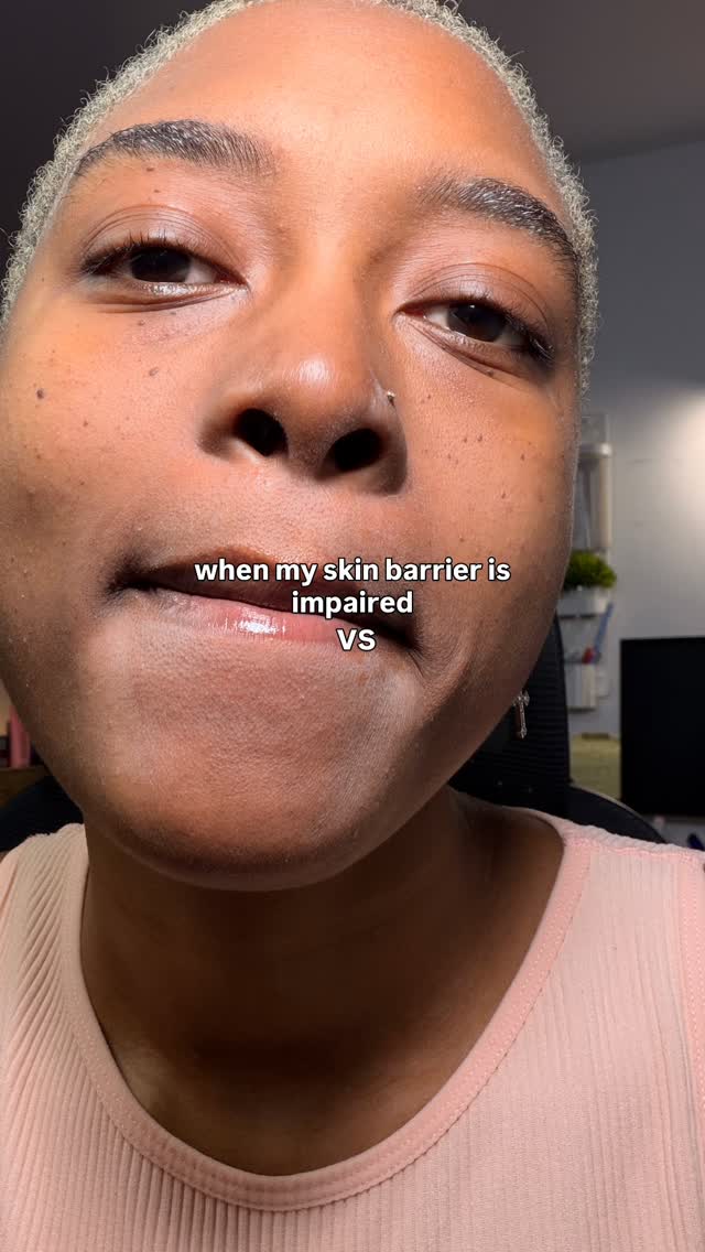 If you do not know how to protect your skin barrier this winter here are a few of my fav options from @haruharuwonder_official
Their Black Rice + Probiotic skincare line is principally designed to address impaired barrier, sensitive and or irrited skin.
Every product in this line plays a key role to repairing and strengthening your skin to tolerate aggression better
1. The Black Rice + Probiotic 2 NAD% serum mist recharges your skin cells helping them fight irritation more effectively while improving skin radiance
2.The Black Rice + Probiotic Ceramide Barrier Cream is loaded with a 5 ceramide complex alongside sooting ingredients that deliver deep hydration which is key to maintain a healthy skin barrier while soothing possible irritation.
3.) The Black Rice + Probiotic Barrier Essence (my fav of the line) with its milky texture nourishes, repairs, hydrates and soothes the skin offering much need support to the skin regenerative process .
⚠️ please note that if you have fungal acne prone skin or skin that easily get clogged these products will most likely irritate your skin!!
Pick on or all three and I guarantee your skin will be one step away for the constant dryness and itchiness that comes with winter
#skincareroutine #winterskincare #haruharuwonder