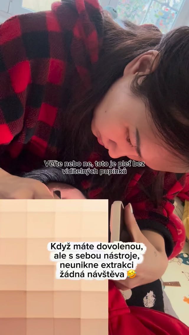 Stále a často si lidé pletou, že
pupínky = nestará se o sebe
a neaknózní pleť = čistá pleť.
Zdání klame a občas to múže být baopak 😅
Extrakce pórů, čištění pleti, kosmetika, kosmetické procedury, akné #peceoplet #akne #acne #kosmeticka #skincare