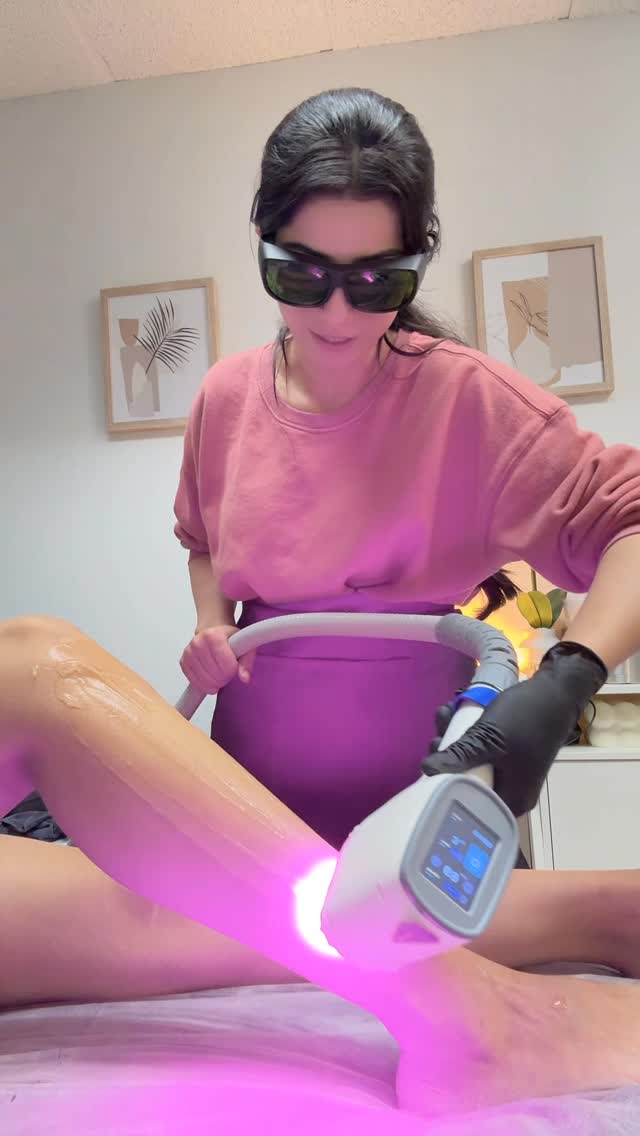 Smooth, long-lasting results with Diode Laser Hair Removal ✨
This advanced laser technology targets the hair follicle at the root to reduce unwanted hair safely and effectively. Diode laser is suitable for a wide range of skin tones and works by delivering precise energy to slow regrowth while keeping the surrounding skin protected.
With consistent sessions, hair grows back finer, lighter, and sparser, leaving skin smoother and irritation-free compared to shaving or waxing. A reliable solution for long-term hair reduction and confident, silky-smooth skin 💙
#DiodeLaser #LaserHairRemoval #SmoothSkinResults #PermanentHairReduction #LaserTreatment HairFreeSkin ProfessionalLaser SkinConfidence AestheticClinic