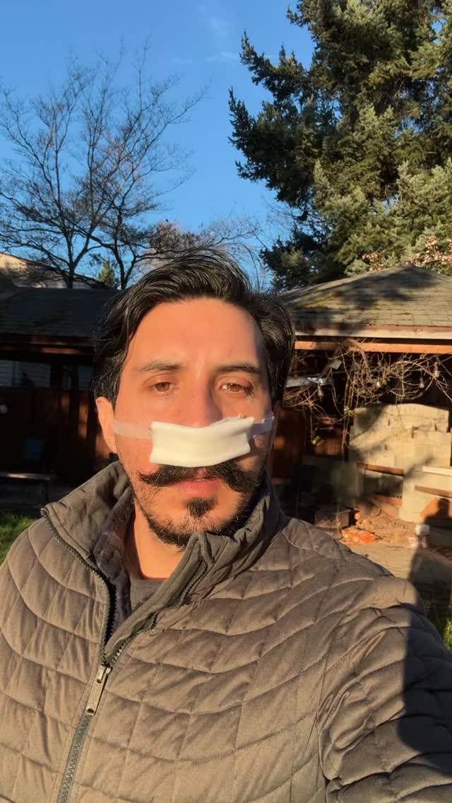 Septoplasty recovery day 2. Going to be smelling wines in 4k and breaking PRs in the gym in 2026. LFG!