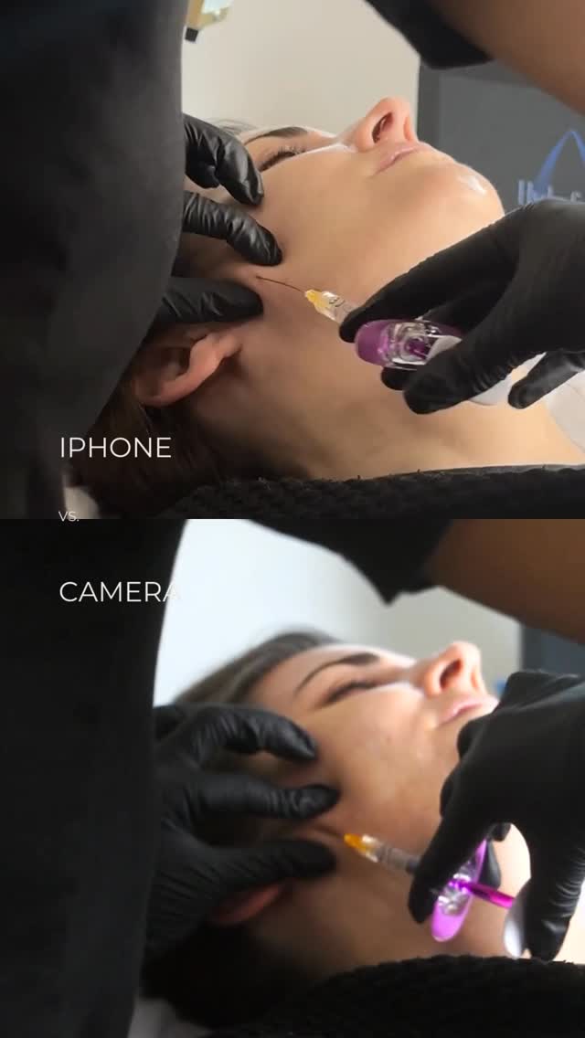 Social media management is often misunderstood as just “posting.” We see it as Curating.
In the medical aesthetics space, your visual identity is the primary indicator of your clinical precision. If your photos look amateur, the subconscious assumption is that your treatments are too.
We bring the studio to your clinic. No shaky phone footage. No ring lights. Just editorial-grade photography and video that captures the texture, lighting, and detail of your work.
One production day. Three months of pristine assets.
We are now allocating dates for March 2026 content shoots. Limited availability for Q1.
Link in bio.
#aestheticmedicine #medicalphotography #contentproduction #149agency #medspamarketing