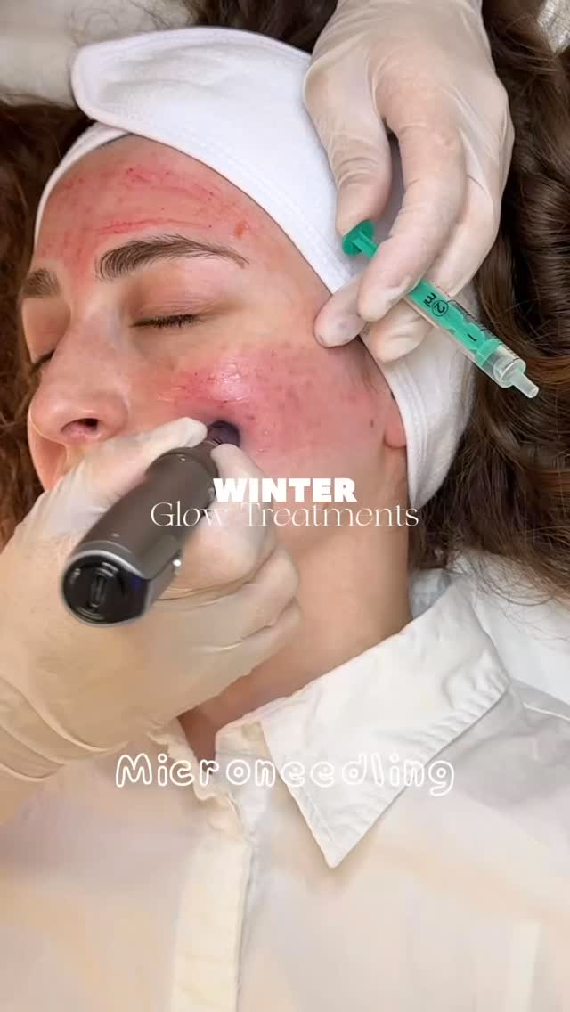 Winter = die wichtigste Zeit für deine Haut 🤍
Diese Behandlungen sind perfekt für die kalte Jahreszeit und helfen deiner Haut, gesund, frisch & glowig zu bleiben
📍Bucher Straße 100
#nürnberg #microneedling #fürthbeauty #kosmetikstudio