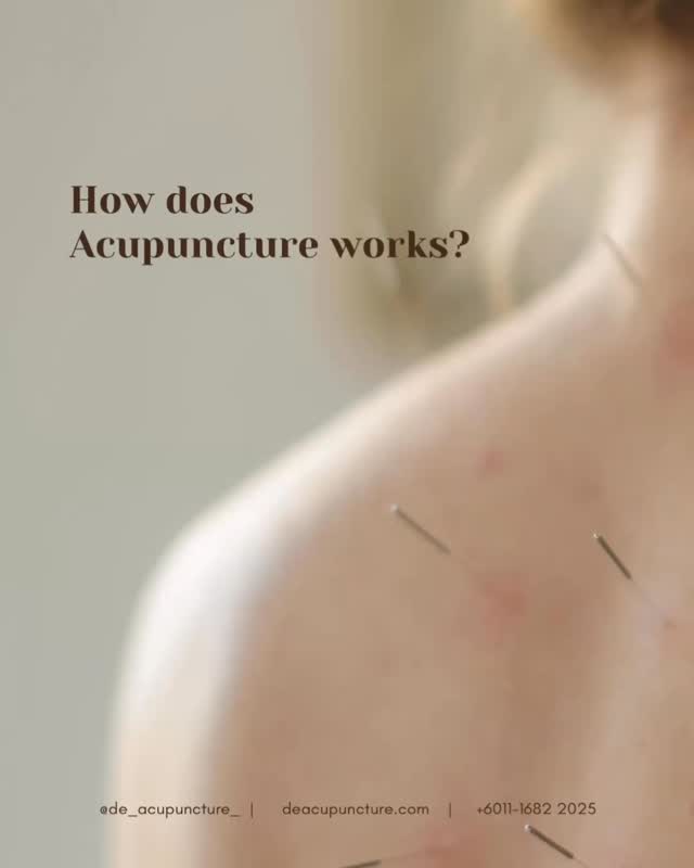 Seriously, how can tiny needles fix your back pain or migraines? Magic?
Nope, it’s just ancient science working its wonders ✨. In TCM, we believe your body has an energy flow called Qi (pronounced ‘chee’). When you’re sick or in pain, it means your Qi is stuck or imbalanced 🚫.
Acupuncture is like a system reset! We insert super fine needles into specific points to unblock that flow, like fixing a traffic jam 🚦.
It signals your body to release its own natural painkillers (Endorphins!) and boosts blood circulation.
The result?
Pain goes down, energy goes up! 🚀 Wanna feel the Qi moving?
Consult our qualified TCM practitioners at 医心医意中医坊 De Acupuncture x Herbs Centre first. We’ll find the real root cause of your pain and tailor a treatment just for you.
Ready to feel the flow?
Click the link in our bio to book your consultation today! 💖
#Acupuncture #TCM #HowItWorks #PainRelief #QiFlow #SubangJaya #USJ #ChineseMedicine #NaturalHealing #Wellness #HealthHack #Meridians #BodyReset #Endorphins #MalaysianHealth